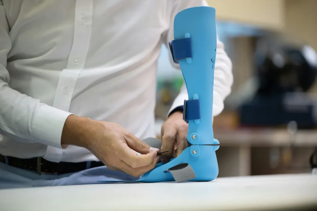 3D-printade proteser i utsatta länder