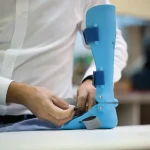 3D-printade proteser i utsatta länder